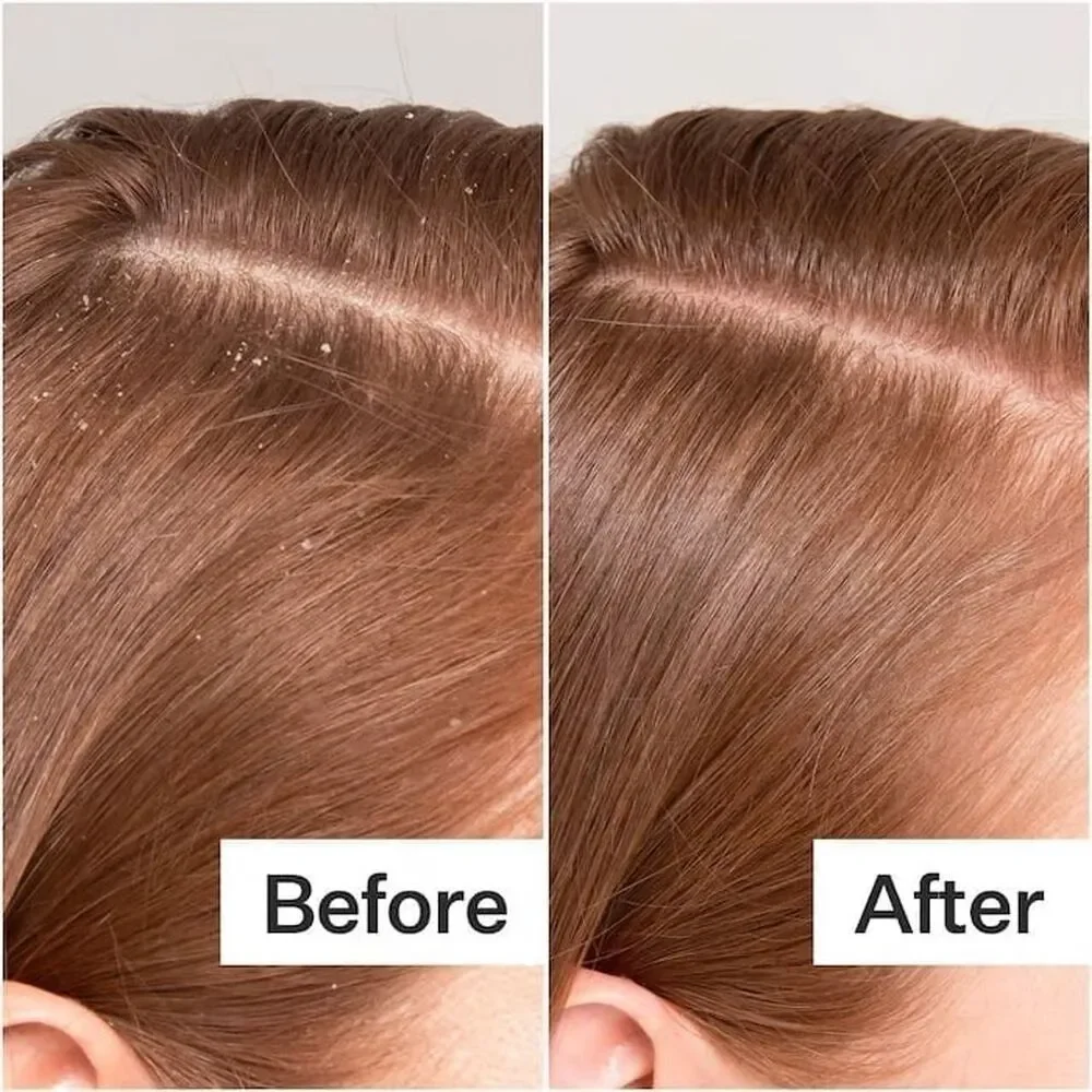 Act+Acre Cold Processed Scalp Detox Oil For Dry Scalp | Brand New In Box